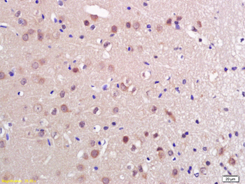 PRL Rabbit Polyclonal Antibody