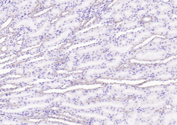 Angiotensin II Type 1 Receptor Rabbit Polyclonal Antibody
