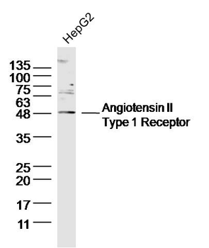 Angiotensin II Type 1 Receptor Rabbit Polyclonal Antibody