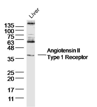 Angiotensin II Type 1 Receptor Rabbit Polyclonal Antibody