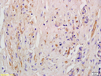 Angiotensin II Type 1 Receptor Rabbit Polyclonal Antibody