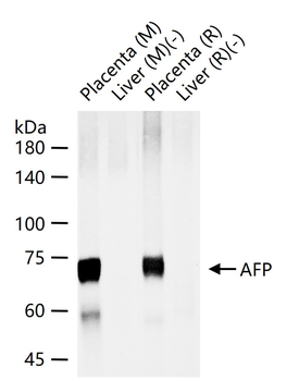 AFP (A2) Mouse Monoclonal Antibody