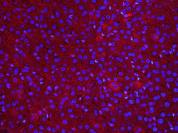 AFP (A2) Mouse Monoclonal Antibody
