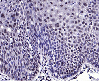 KAT4/TAF1 Rabbit Polyclonal Antibody