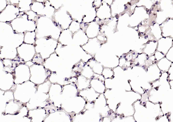 Phospho-c-Abl (Tyr226) Rabbit Polyclonal Antibody