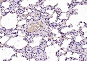 Phospho-c-Abl (Tyr226) Rabbit Polyclonal Antibody