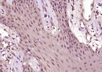 Phospho-Akt (Thr450) Rabbit Polyclonal Antibody