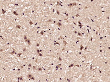 Phospho-Akt (Thr450) Rabbit Polyclonal Antibody