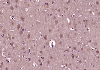 Phospho-Akt (Thr450) Rabbit Polyclonal Antibody