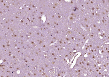 Phospho-c-Abl (Tyr283) Rabbit Polyclonal Antibody