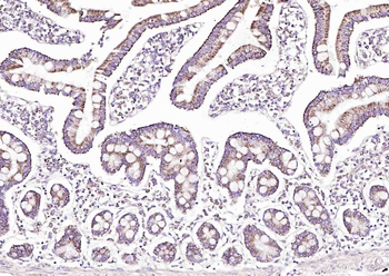 SOAT2 Rabbit Polyclonal Antibody