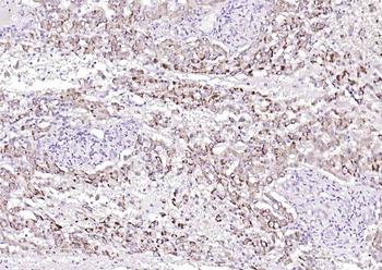 SOAT2 Rabbit Polyclonal Antibody