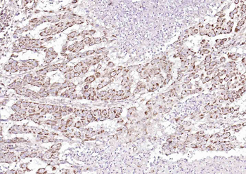 SOAT2 Rabbit Polyclonal Antibody