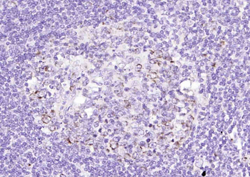 SOAT2 Rabbit Polyclonal Antibody