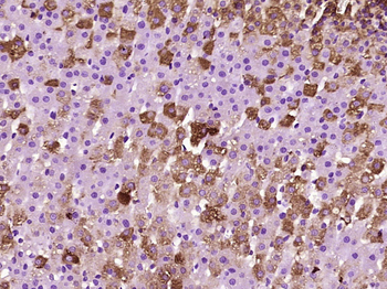 SOAT2 Rabbit Polyclonal Antibody