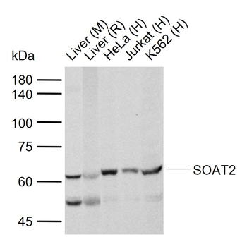 SOAT2 Rabbit Polyclonal Antibody