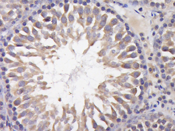 Phospho-CBL (Tyr700) Rabbit Polyclonal Antibody