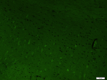 Alpha Dystroglycan Rabbit Polyclonal Antibody