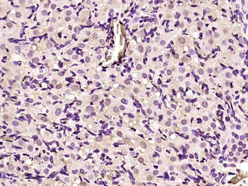 Phospho-APC1 (Ser355) Rabbit Polyclonal Antibody