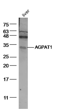 AGPAT1 Rabbit Polyclonal Antibody