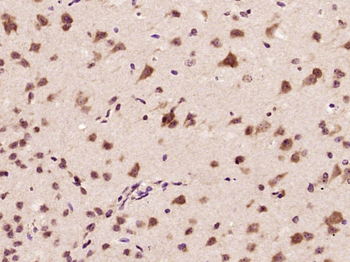 CARM1 Rabbit Polyclonal Antibody