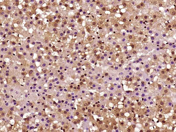 CARM1 Rabbit Polyclonal Antibody