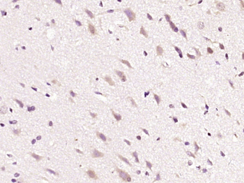 CARM1 Rabbit Polyclonal Antibody