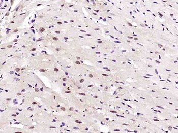 Phospho-AMPK alpha-1 (Thr183) Rabbit Polyclonal Antibody