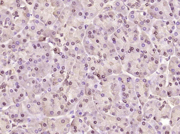 Phospho-AMPK alpha-1 (Thr183) Rabbit Polyclonal Antibody