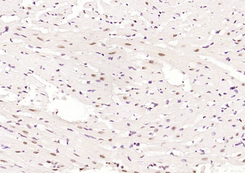 Phospho-AMPK alpha-1 (Thr183) Rabbit Polyclonal Antibody