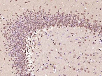 Phospho-AMPK alpha-1 (Thr183) Rabbit Polyclonal Antibody