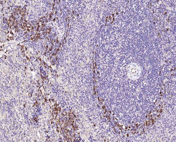 Phospho-VAV1 (Tyr174) Rabbit Polyclonal Antibody