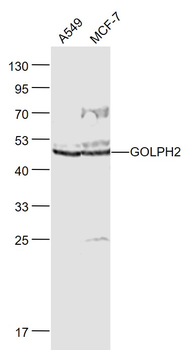 GOLPH2 Rabbit Polyclonal Antibody