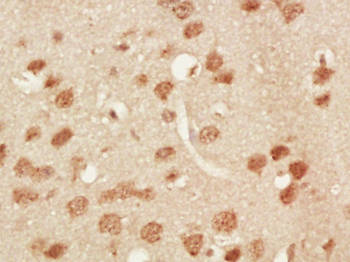 Phospho-TNIK (Ser764) Rabbit Polyclonal Antibody