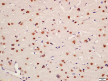 Phospho-TNIK (Ser764) Rabbit Polyclonal Antibody