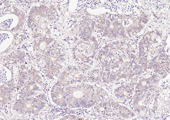 Phospho-PRKD1 (Ser738) Rabbit Polyclonal Antibody