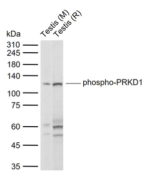Phospho-PRKD1 (Tyr463) Rabbit Polyclonal Antibody