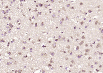 Phospho-CPI17 alpha (Thr38) Rabbit Polyclonal Antibody