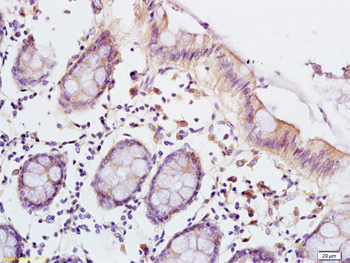 LSP1 Rabbit Polyclonal Antibody