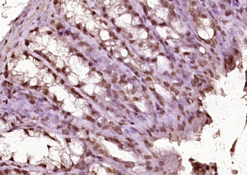 Phospho-SOX9 (Ser181) Rabbit Polyclonal Antibody