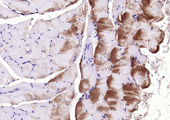 CACNA1S Rabbit Polyclonal Antibody (Biotin)