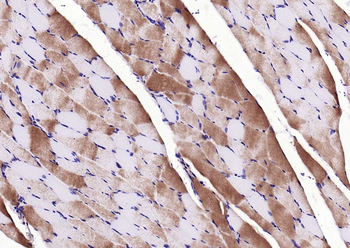 CACNA1S Rabbit Polyclonal Antibody (Biotin)