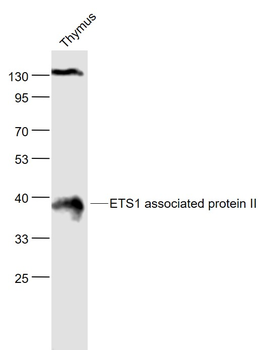 TDP2 Rabbit Polyclonal Antibody
