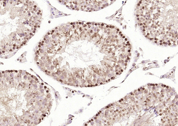 Phospho-BRIP1/BACH1 (Ser990) Rabbit Polyclonal Antibody