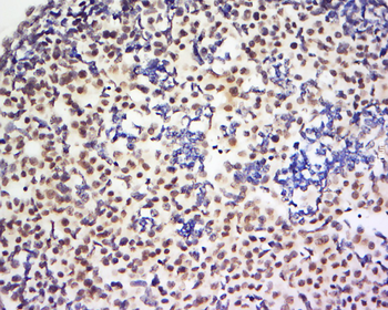 Phospho-BRIP1/BACH1 (Ser990) Rabbit Polyclonal Antibody