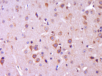CTNNBIP1 Rabbit Polyclonal Antibody