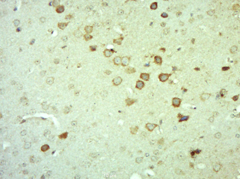 CTNNBIP1 Rabbit Polyclonal Antibody