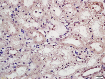 Phospho-CTNNBIP1 (Thr43+Ser50) Rabbit Polyclonal Antibody