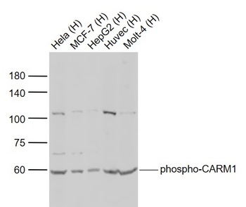 Phospho-CARM1 (Ser228) Rabbit Polyclonal Antibody