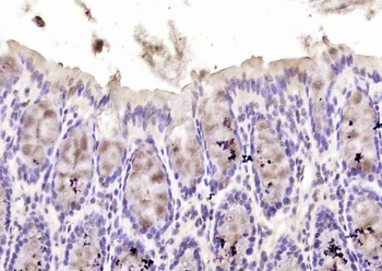 Phospho-TNIK (Ser769) Rabbit Polyclonal Antibody